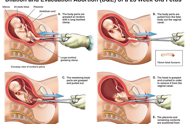 de Former abortionist: Abortion ‘is an act of depravity that society should not permit’ featured image