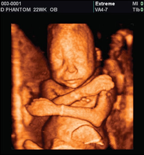 Ambulance called as woman hemorrhages after elective abortion on 24-week baby image