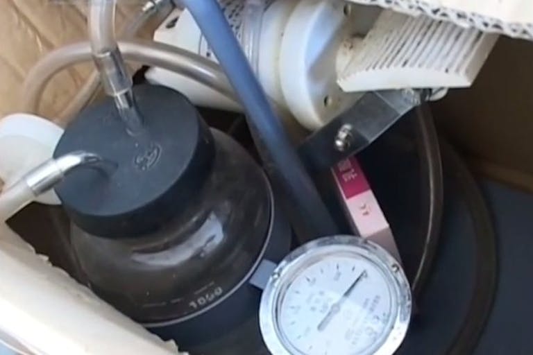 fetal-gender-determination