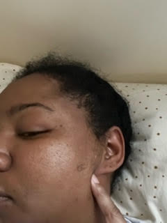 Lila in the hospital indicating one of the injuries she suffered