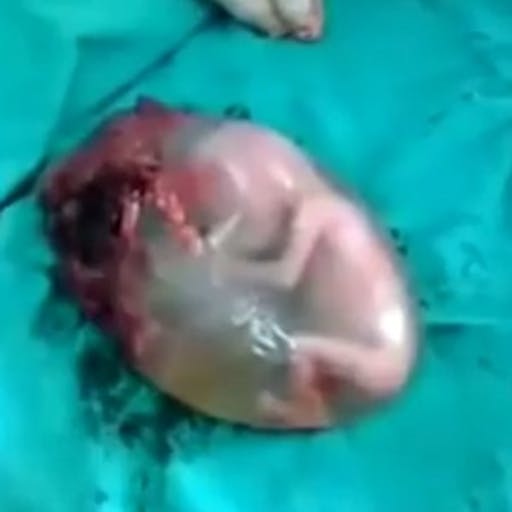 human-fetus