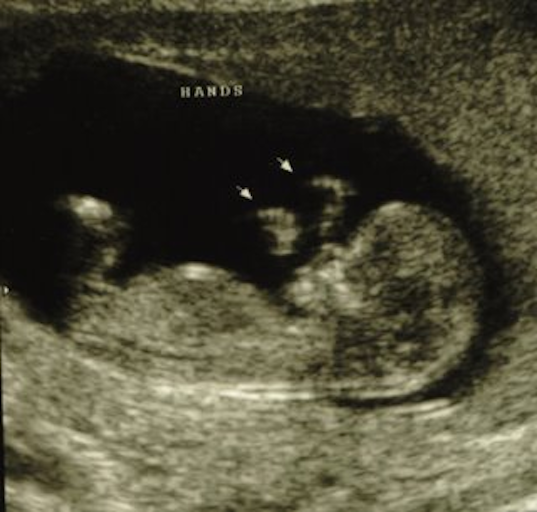 12Weeks