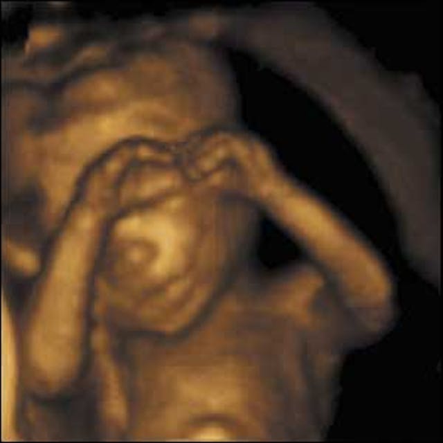 The beauty – and humanity – that ultrasounds show us The beauty - and humanity - that ultrasounds show us