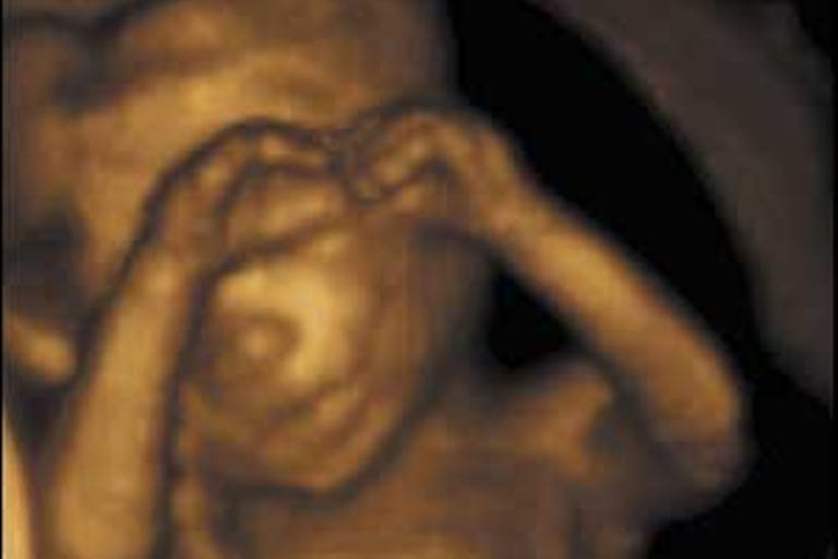 The beauty – and humanity – that ultrasounds show us The beauty - and humanity - that ultrasounds show us