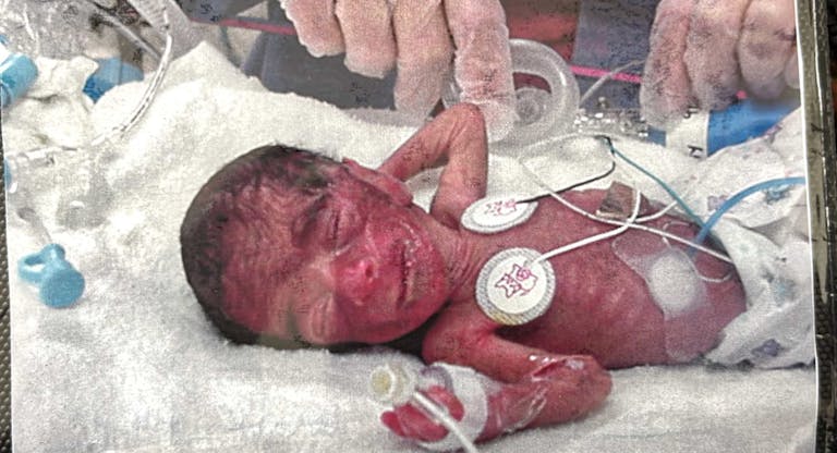 alisha at birth