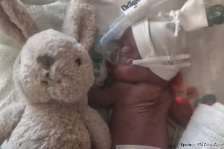 23 week preemie dali