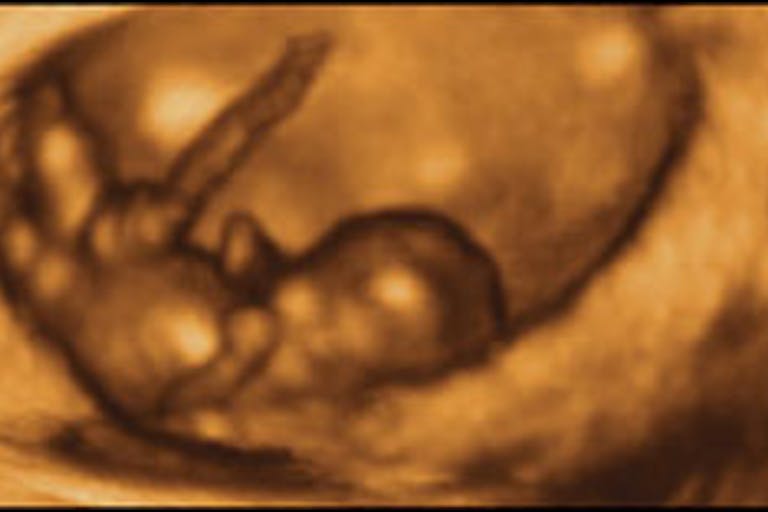 "At 8 weeks, this baby can kick and straighten his legs, and move his arms up and down." This and other incredible 4D ultrasound photos can be found here - copyright of Life Dynamics.