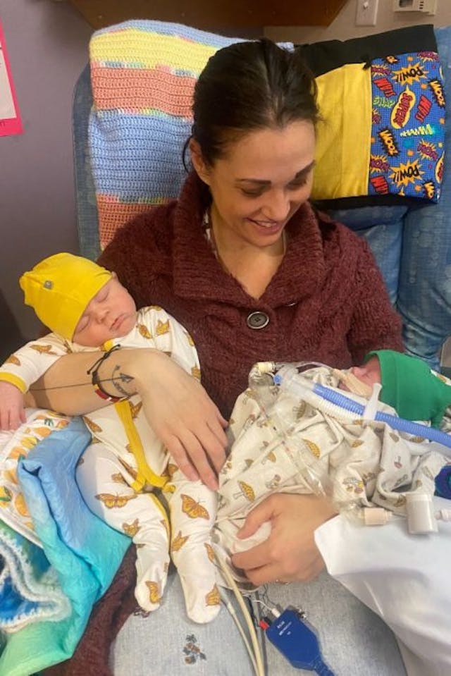 Jessie, Oren, and Abel. Do not reprint. Twins, trisomy 18, abortion