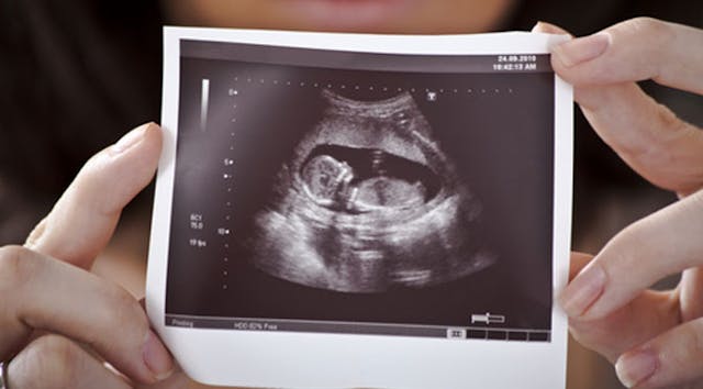 Over 3,000 women tell Supreme Court: Abortion facilities lied to us image