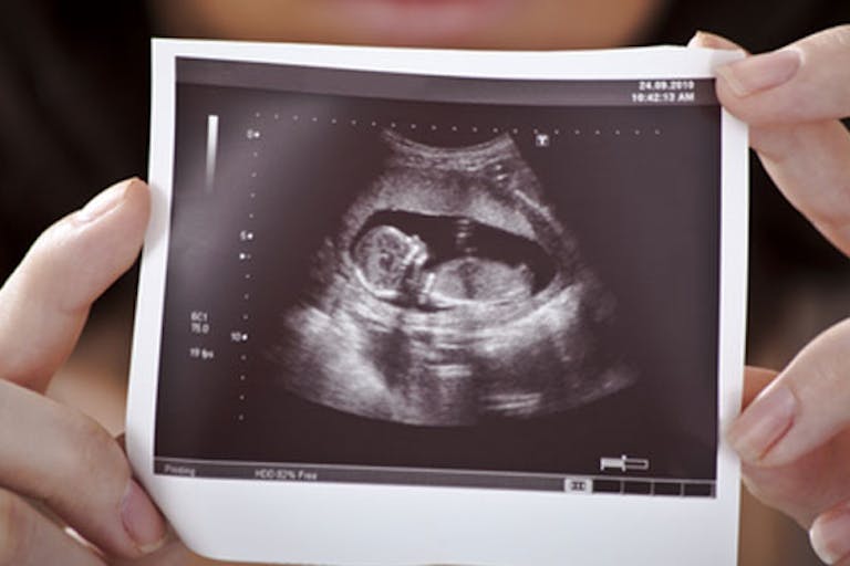 Over 3,000 women tell Supreme Court: Abortion facilities lied to us image
