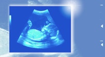 20-week baby scan