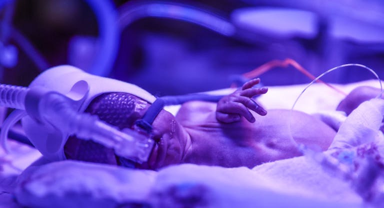 Quintuplets Born In Krakow, Poland