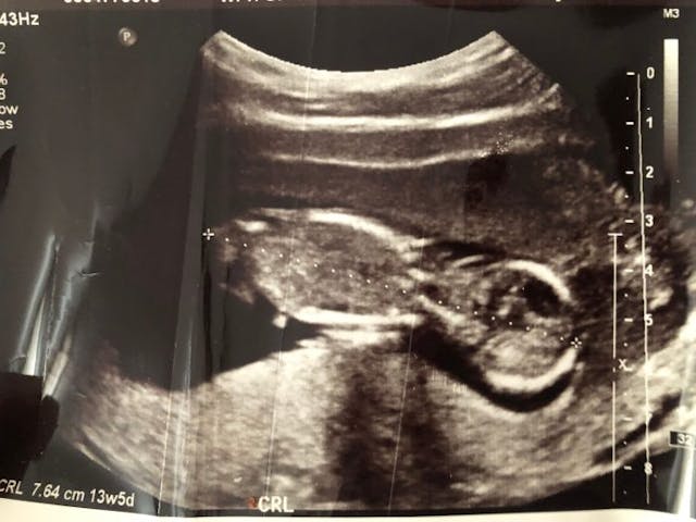 Ultrasound image of Eliana Rose at 13 weeks 5 days. (Do not reprint photo without express permission of owner.)