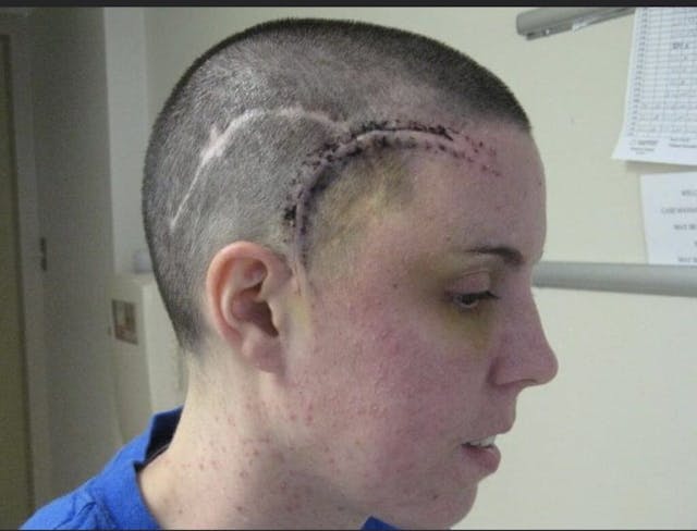 Photo via Save the Storks Photo via Save the Storks