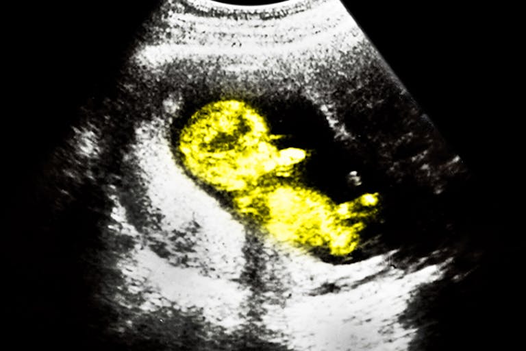 ultrasounds-baby-2-1