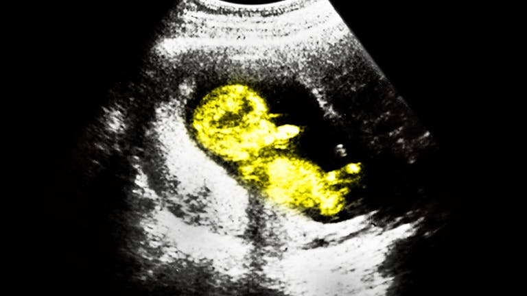 ultrasounds-baby-2-1