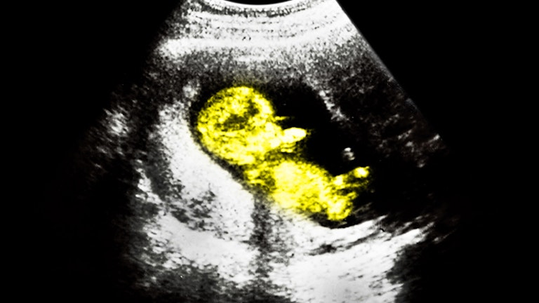 ultrasounds-baby-2-1