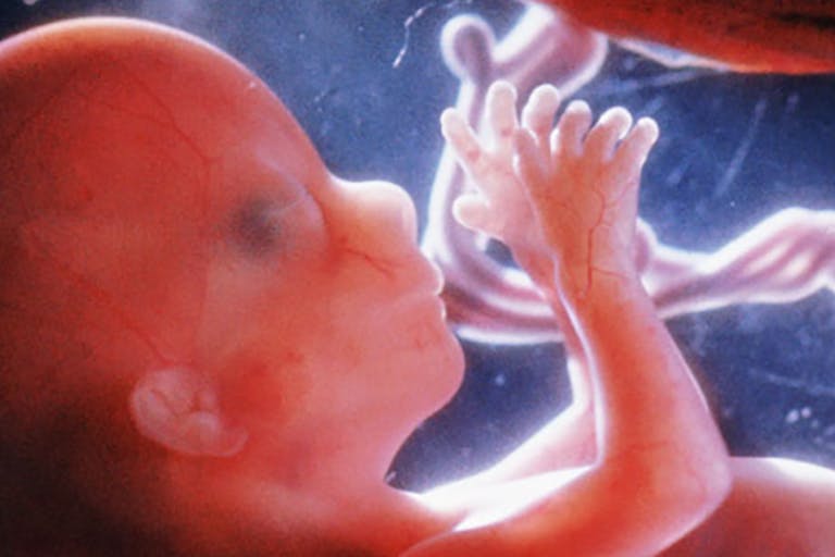 Preborn baby at 16 weeks preborn baby 16 weeks