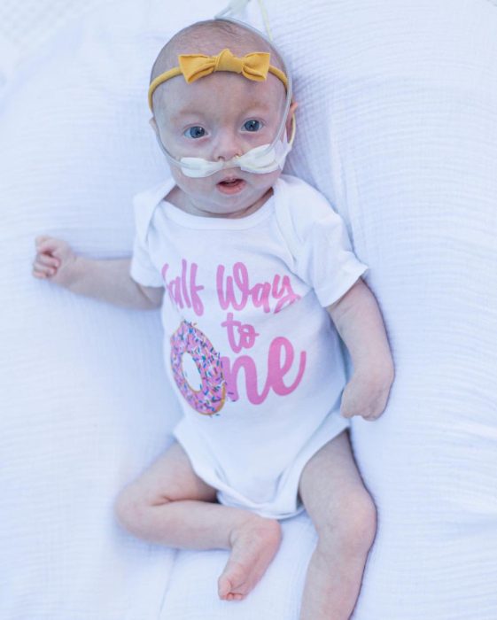 Eden at 6 months (Photo courtesy of Tyler Anderson)