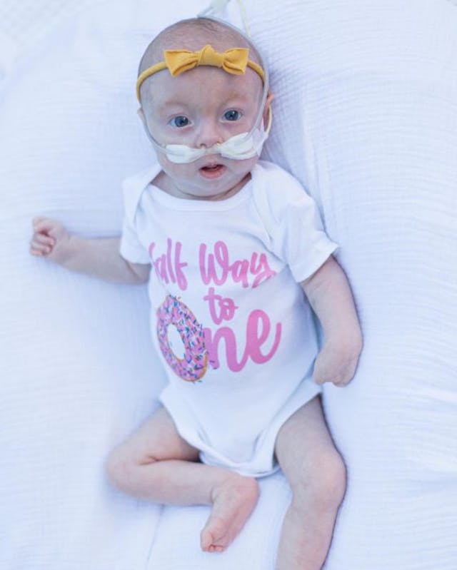 Eden at 6 months (Photo courtesy of Tyler Anderson) Eden at 6 months (Photo courtesy of Tyler Anderson)