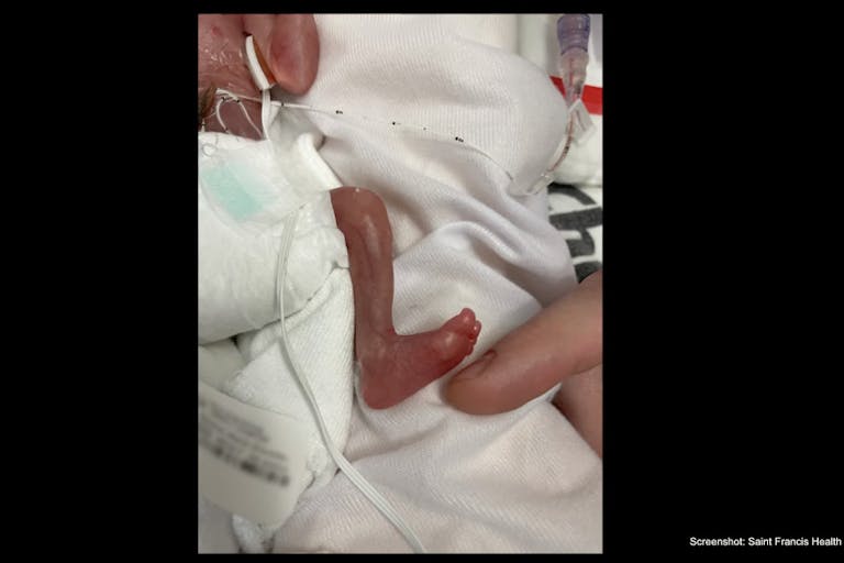 preemie Jo saint francis