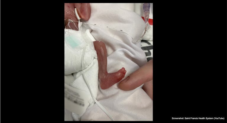 preemie Jo saint francis