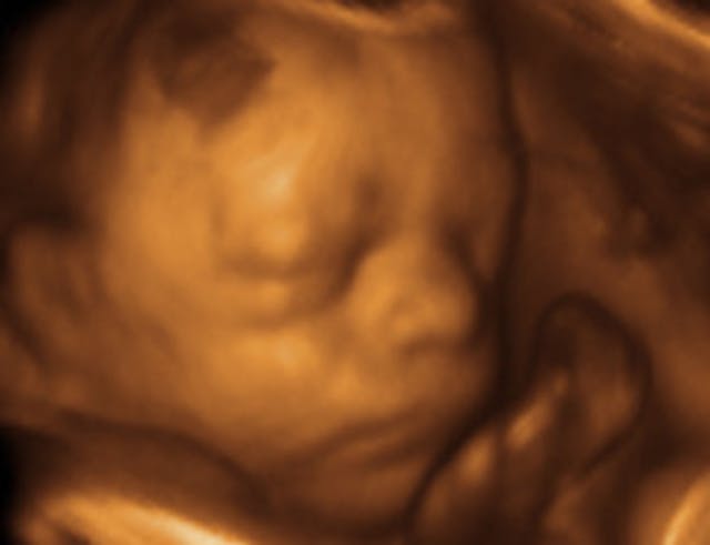 3d-ultrasound-fetus-baby2