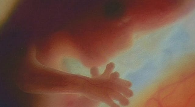 Preborn child at 12 weeks abortion, preborn