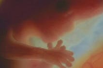 Preborn child at 12 weeks abortion, preborn