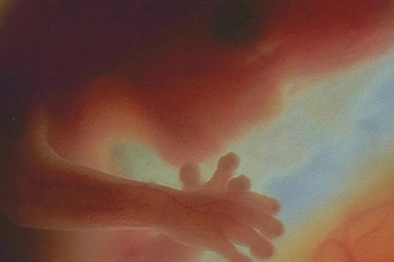 Preborn child at 12 weeks abortion, preborn