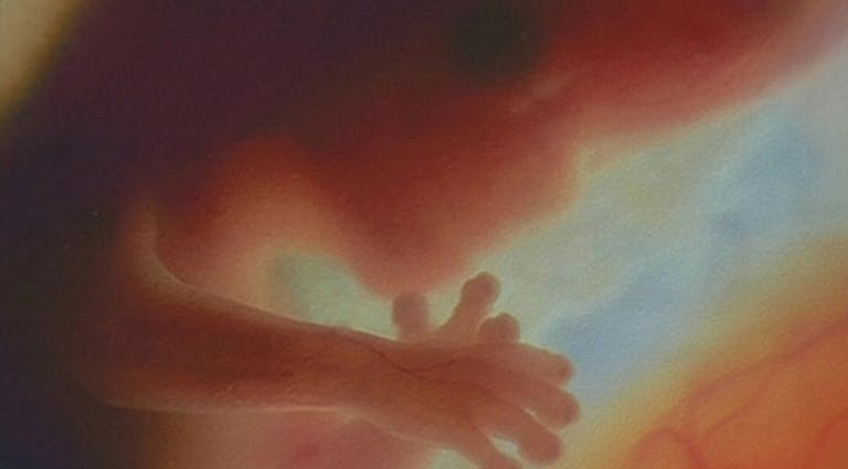 abortion, preborn