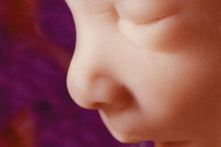 16 weeks First trimester babies aren’t blobs of tissue — they’re amazingly complex image