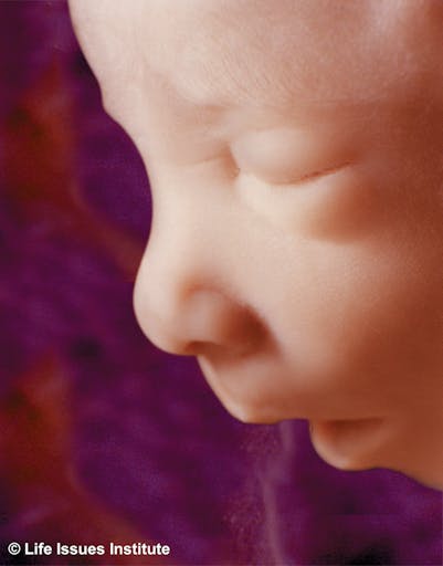 First trimester babies aren’t blobs of tissue — they’re amazingly complex image