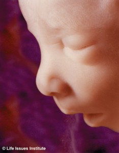 Post-abortive mother: Listen to the voice of your child image