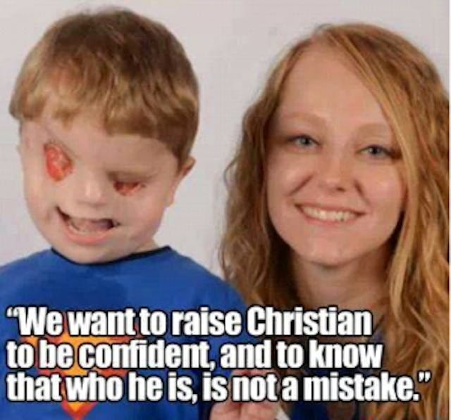 He wasn't a typical newborn, but he has always been equally valuable.