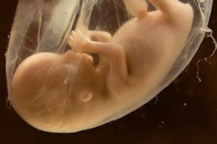 human-fetus