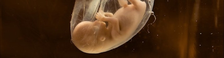 human-fetus