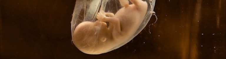 human-fetus
