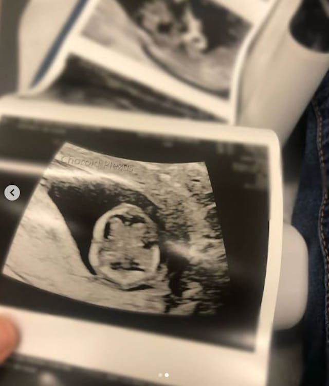 via Albany Rose  . Pro-life activist shares remarkable scan of 12-week-old preborn baby’s brain image