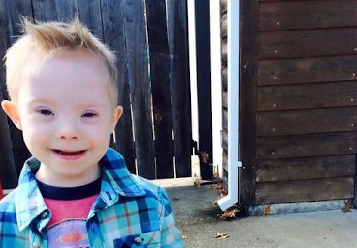 Holt down syndrome