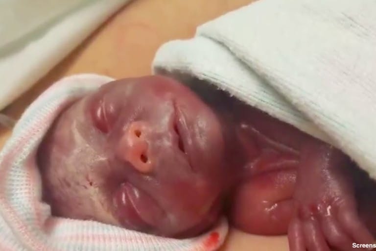 elliot finnefrock preemie