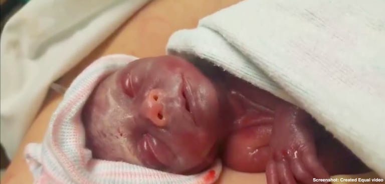 elliot finnefrock preemie