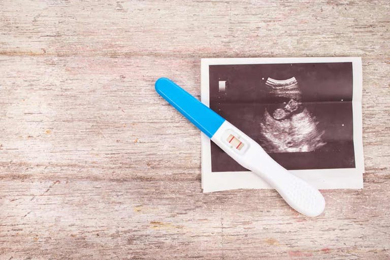 abortion waiting period, heartbeat, ultrasound, pregnancy