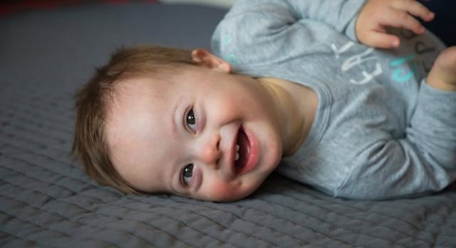 Portrait of cute baby boy with Down syndrome on the bed in home bedroom (Getty Images) Down syndrome