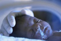 Photo: ER Productions Limited/Getty Images Photo of preemie in NICU
