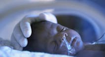 Photo of preemie in NICU