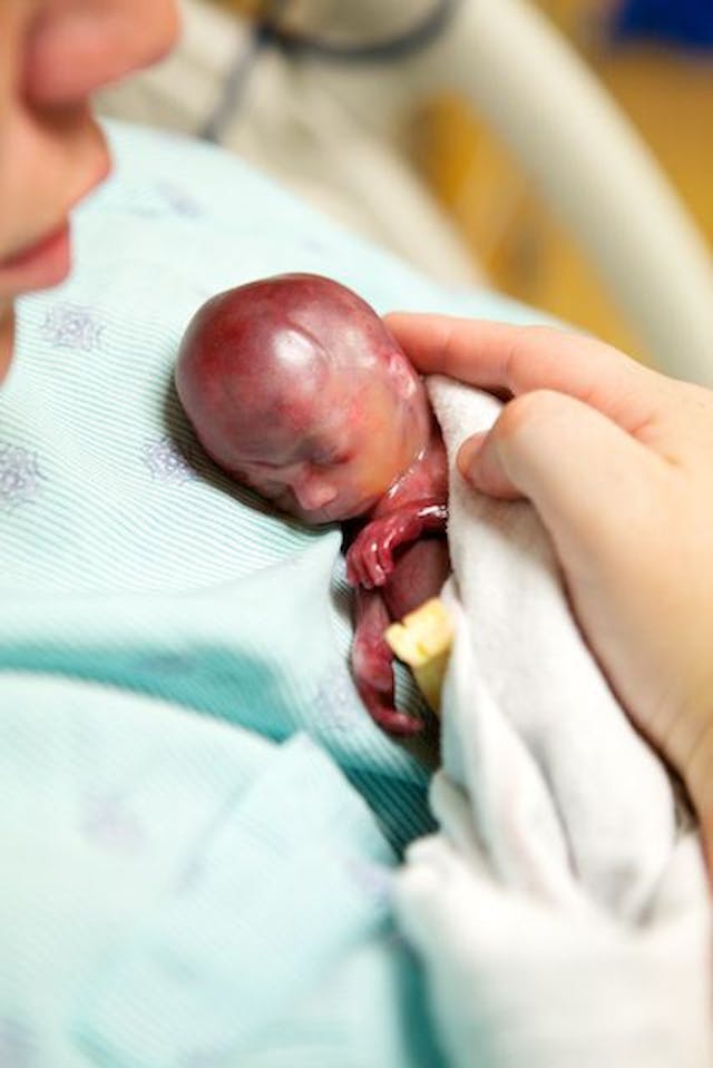 Baby Walter at 19 weeks. Cecile Richards' Planned Parenthood aborts babies at this age.