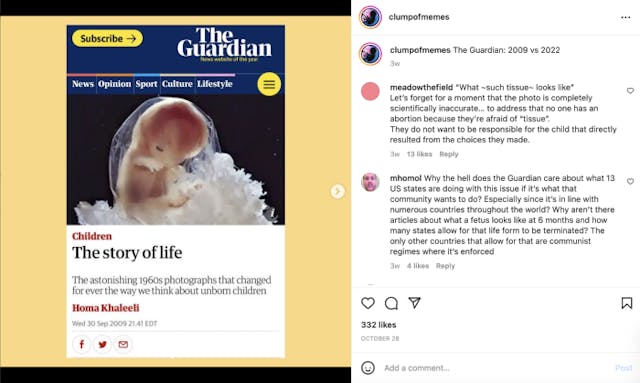 Mom shares images of 10-week miscarried twins, refuting Guardian’s ‘pregnancy tissue’ farce image