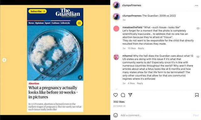 Mom shares images of 10-week miscarried twins, refuting Guardian’s ‘pregnancy tissue’ farce image