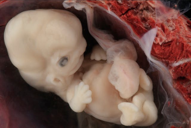 Human embryo, 6-7 weeks post-fertilization. 8-9 weeks since the last menstrual period. heartbeat, embryo, preborn